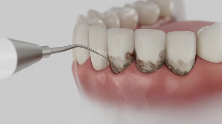 Reliable Dental contractor in Mount Pleasant, SC by Smile Center Dentistry